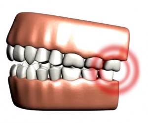 Jaw pain and TMJ headaches are common symptoms of TMJ dysfunction.
